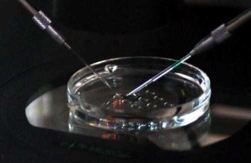 济南代妈试管代怀,供精试管婴儿的精子是谁的_在上海找供卵去哪里_医保卡里的