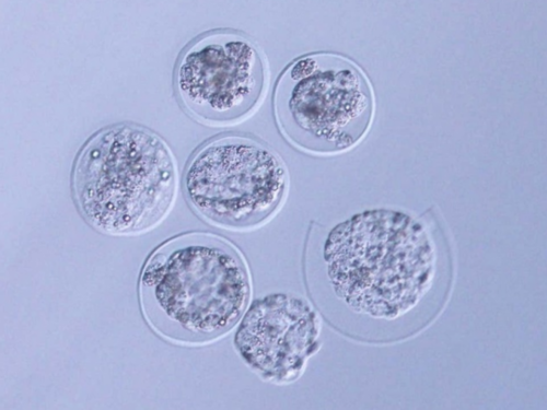 济南可以代生孩子,做试管婴儿需要多少天？28天泰国短方案-上海供卵试管双胞