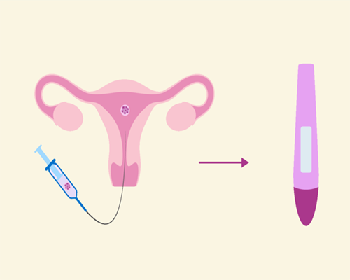 河南哪个医院有精子库！想做供精试管婴儿请先满足这