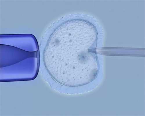 医院供卵费用_正规供卵中心,安康哪里做供卵试管婴儿,宜昌哪里做供卵试管婴