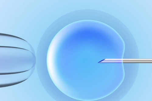 济南代怀价钱,做试管婴儿的具体步骤，最后一步不可忽视！-上海供卵试管双胞