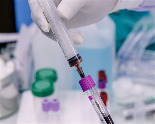 怎么从检查单上看胎儿性别？检查单上看胎儿性别准吗？