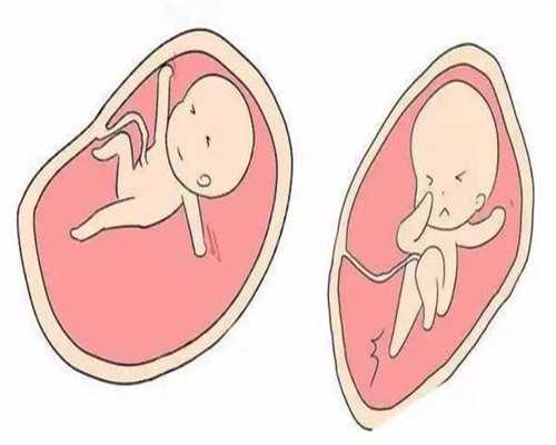 济南代怀代怀价格,正常人可以做试管婴儿吗？-上海供卵试管公司有哪些_济南山