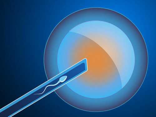 上海世纪助孕生殖中心_上海世纪助孕生殖中心,武汉代生是多少合适 武汉供卵生