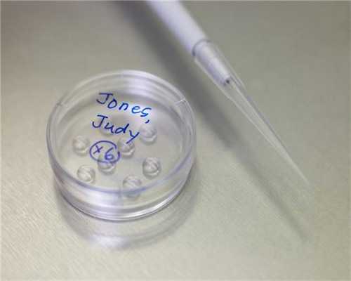 输卵管造影术：输卵管造影术痛吗?