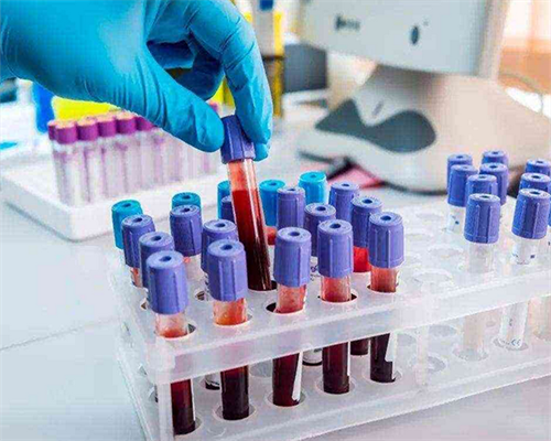 济南医院代生费用,2026年5月27日美国试管婴儿SDFC北京公益咨询会_辅助生殖专业