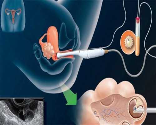 济南代怀孕网费用,做第一代试管婴儿移植武汉同济医院一般需要哪些过程？-腰