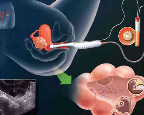 济南代孕顶尖医院,江西做试管能做男宝吗？在江西试管可不可以选男孩？_台湾