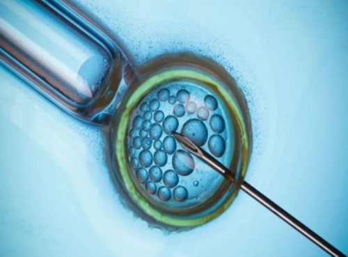 济南助孕供卵咨询,2026
上海瑞金医院三代试管费用多少_生男生女阳历计算公式