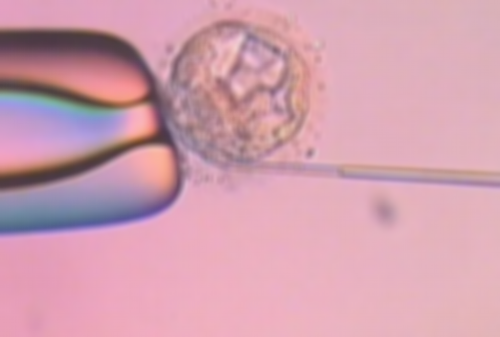 济南三代试管生殖中心 2026济南做供卵试管生男孩条件解析 ‘彩超30周看男女准