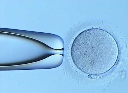 济南代怀最靠谱,济南同性在哪里可以做试管婴儿-试管生殖助孕机构-东北试管婴