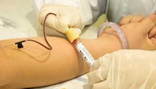 济南找妇女代怀,天津胚胎染色体异常做三代试管,告别高昂助孕费用-两次宫外孕